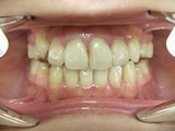 CIMG3537-4.jpg